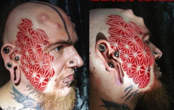 face scarification